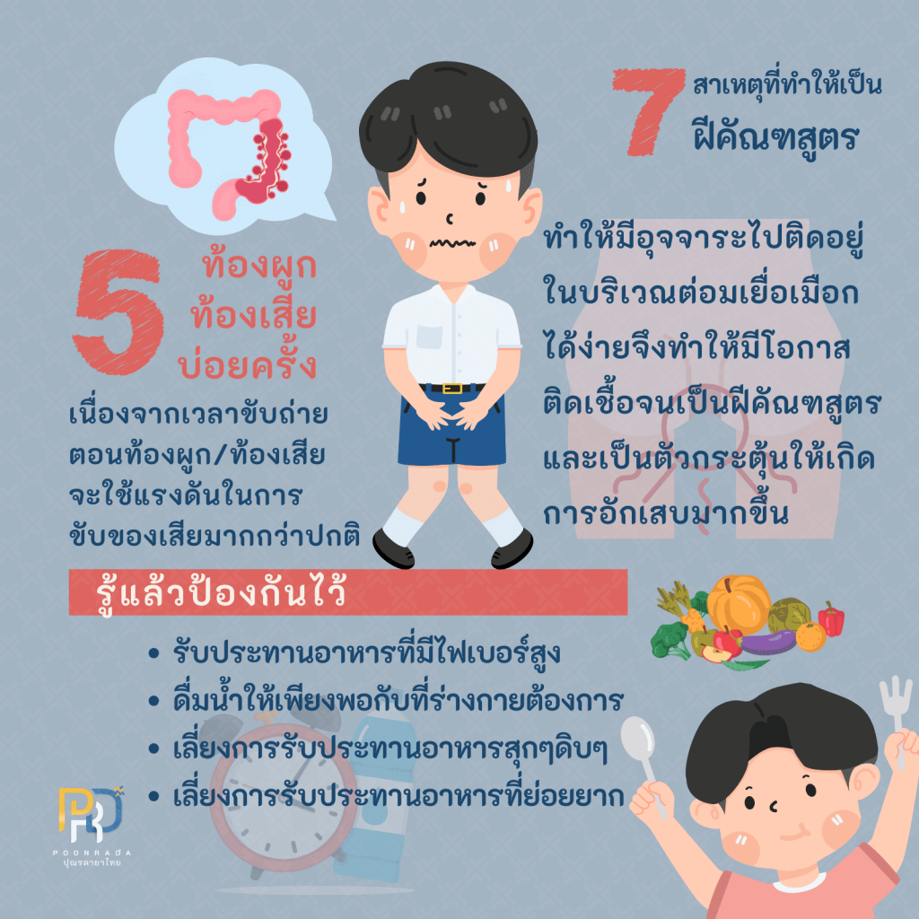 วิธีป้องกันฝีคัณฑสูตร 5