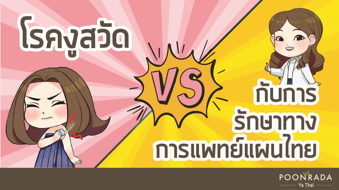 โรคงูสวัด กับ การรักษาทางการแพทย์แผนไทย