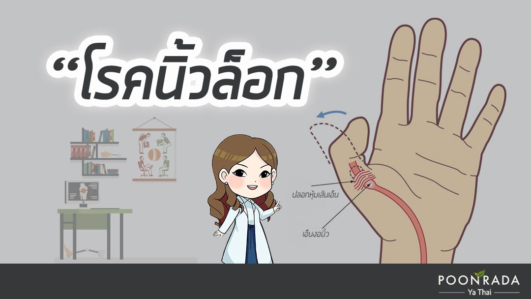 โรคนิ้วล็อค