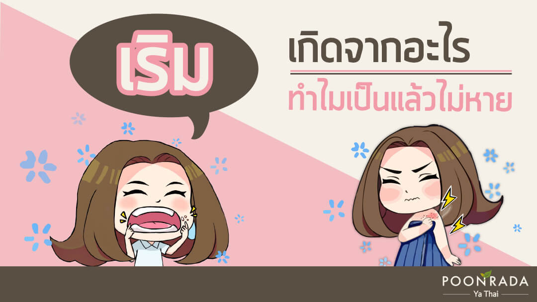 เริมเกิดจากอะไร ทำไม่เป็นแล้วไม่หาย