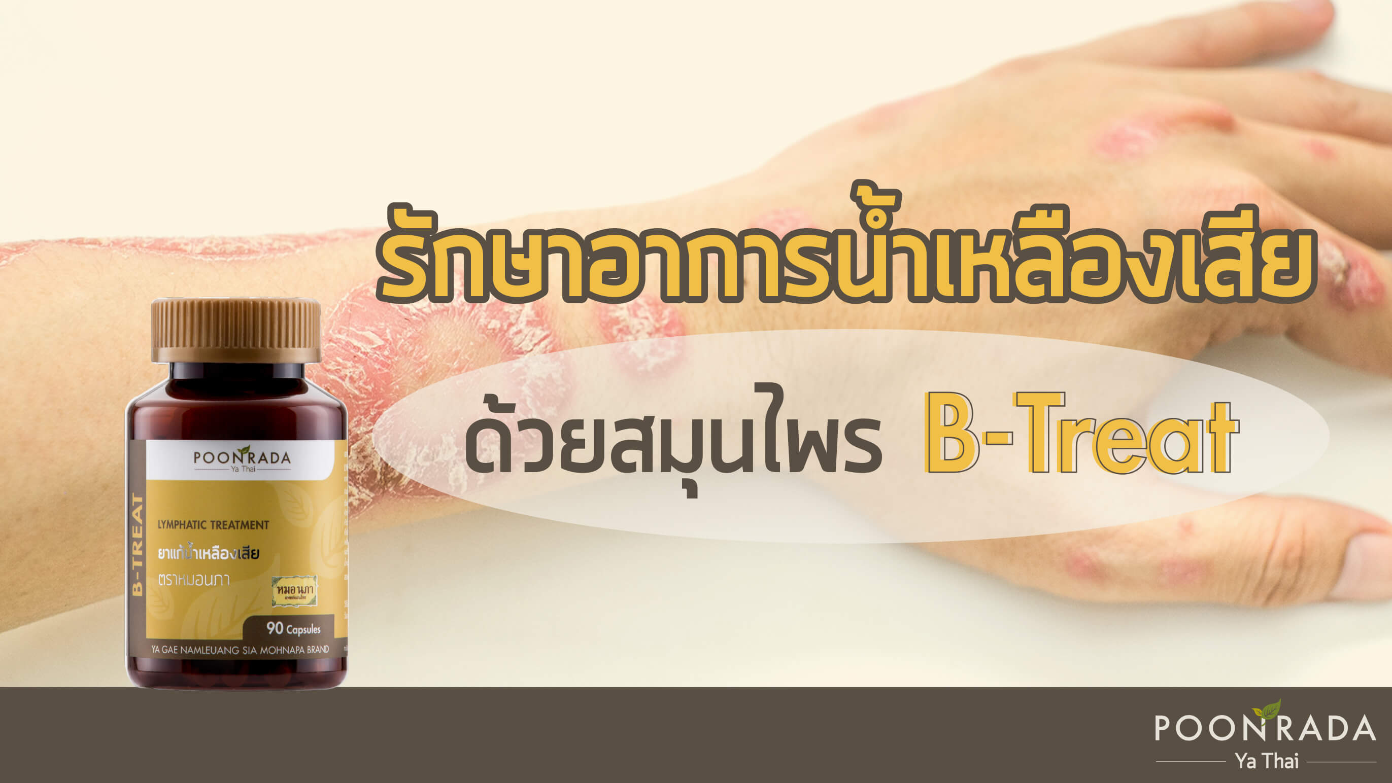 รักษาอาการน้ำเหลืองเสียด้วยสมุนไพร B-Treat