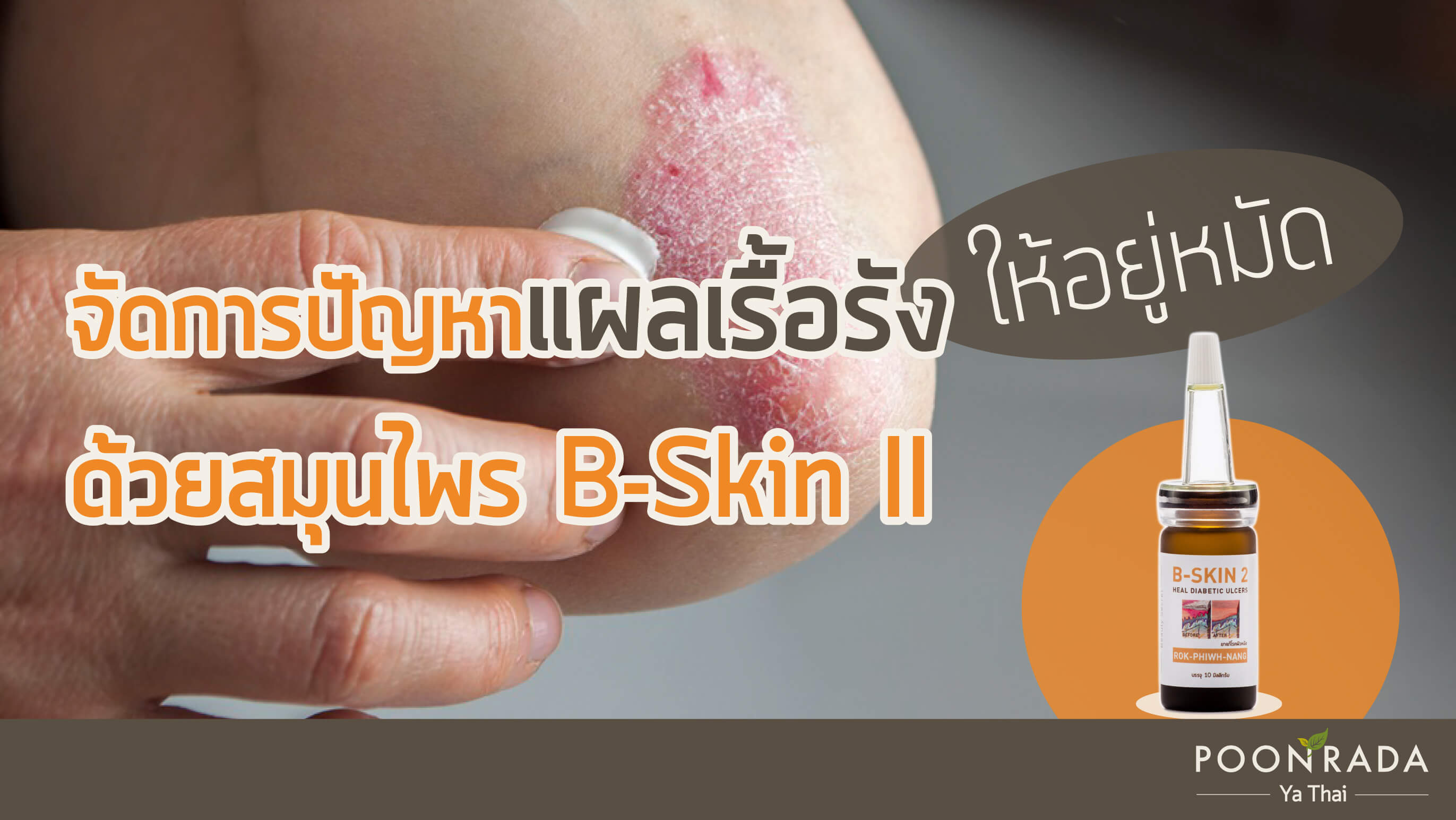 จัดการปัญหาแผลเรื้อรังให้อยู่หมัดด้วยสมุนไพร B-Skin II