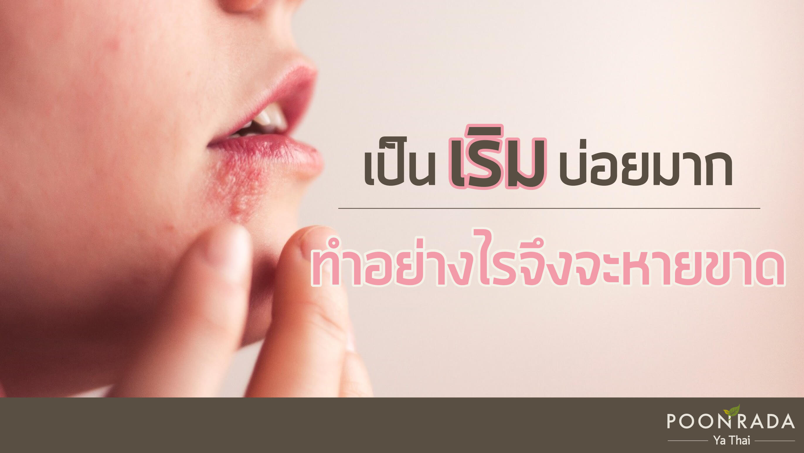 เป็นเริมบ่อยมาก ทำอย่างไรจึงจะหายขาด