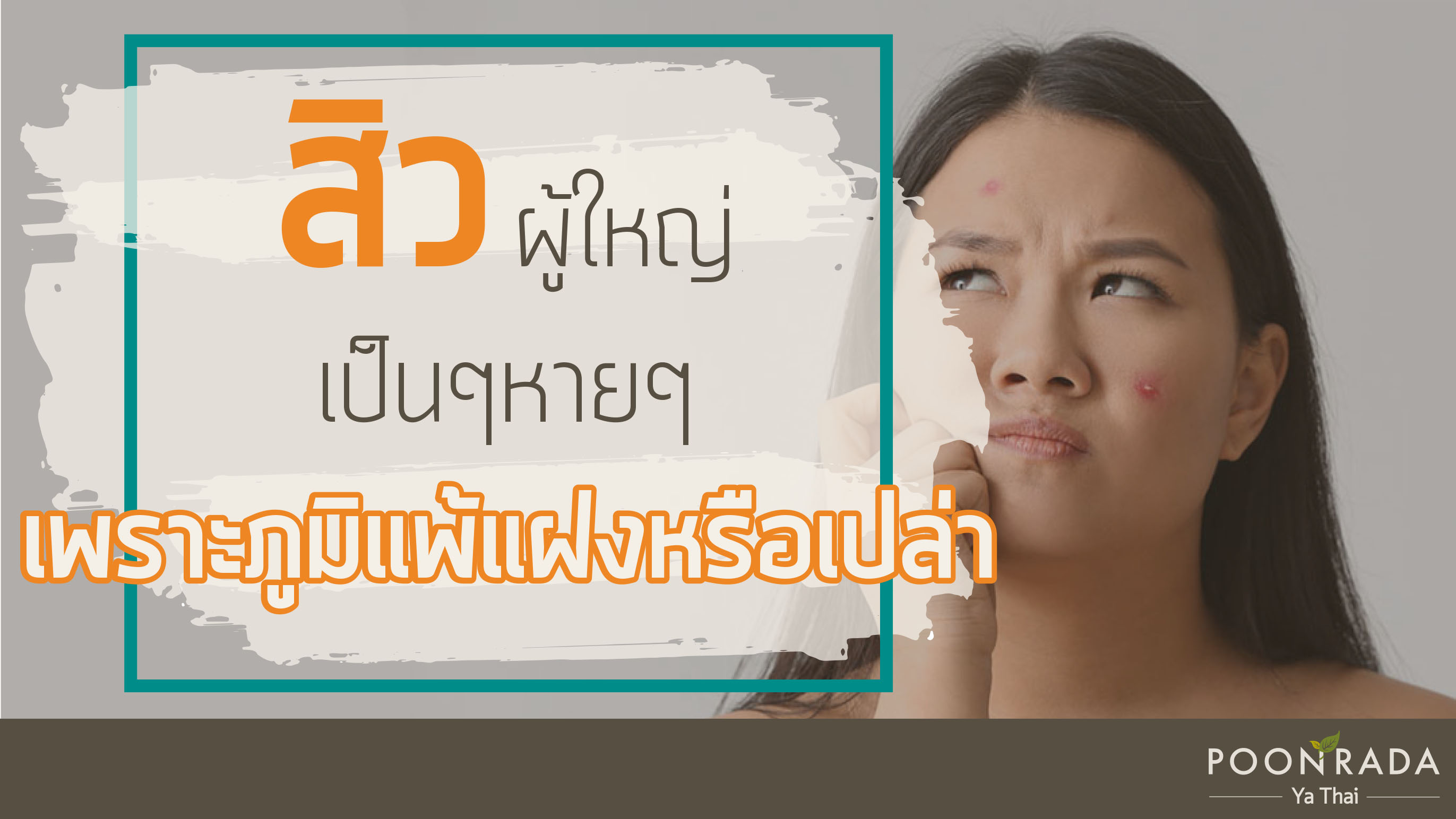 สิวผู้ใหญ่ เป็นๆหายๆ เพราะภูมิแพ้แฝงหรือเปล่า