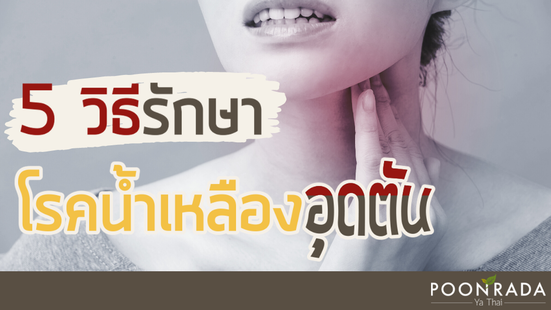 5วิธีรักษา โรคน้ำเหลืองอุดตัน