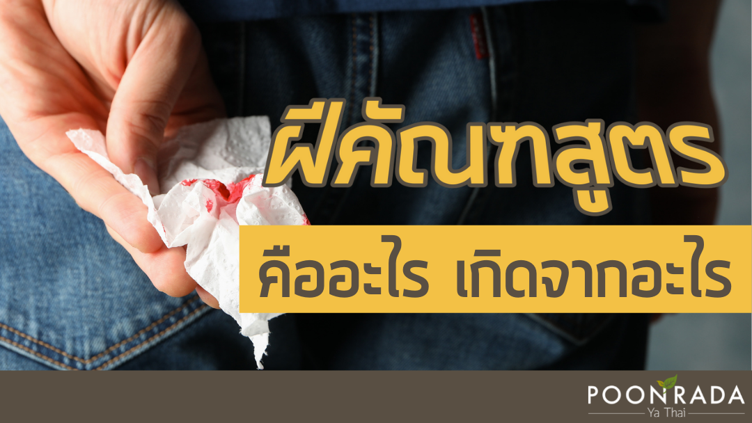 ฝีคัณฑสูตร คืออะไร เกิดจากอะไร