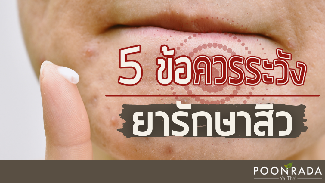 5ข้อควรระวัง! ยารักษาสิว