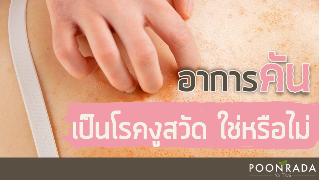 อาการคัน เป็นโรคงูสวัด ใช่หรือไม่?