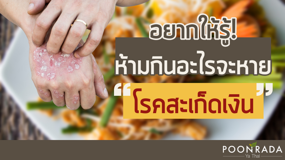 อยากให้รู้! ห้ามกินอะไรจะหาย "สะเก็ดเงิน"