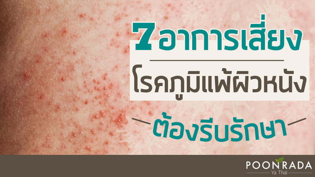 7อาการเสี่ยง "โรคภูมิแพ้ผิวหนัง" ต้องรีบรักษา!