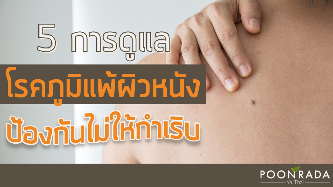 5 การดูแล โรคภูมิแพ้ผิวหนัง ป้องกันไม่ให้กำเริบ