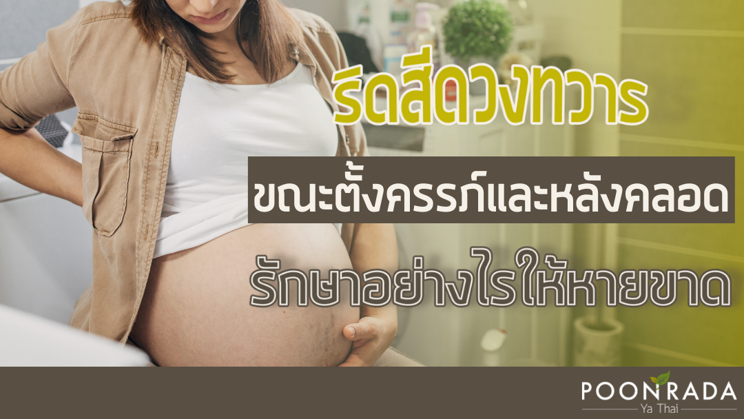 ริดสีดวงทวารขณะตั้งครรภ์และหลังคลอด รักษาอย่างไรให้หายขาด