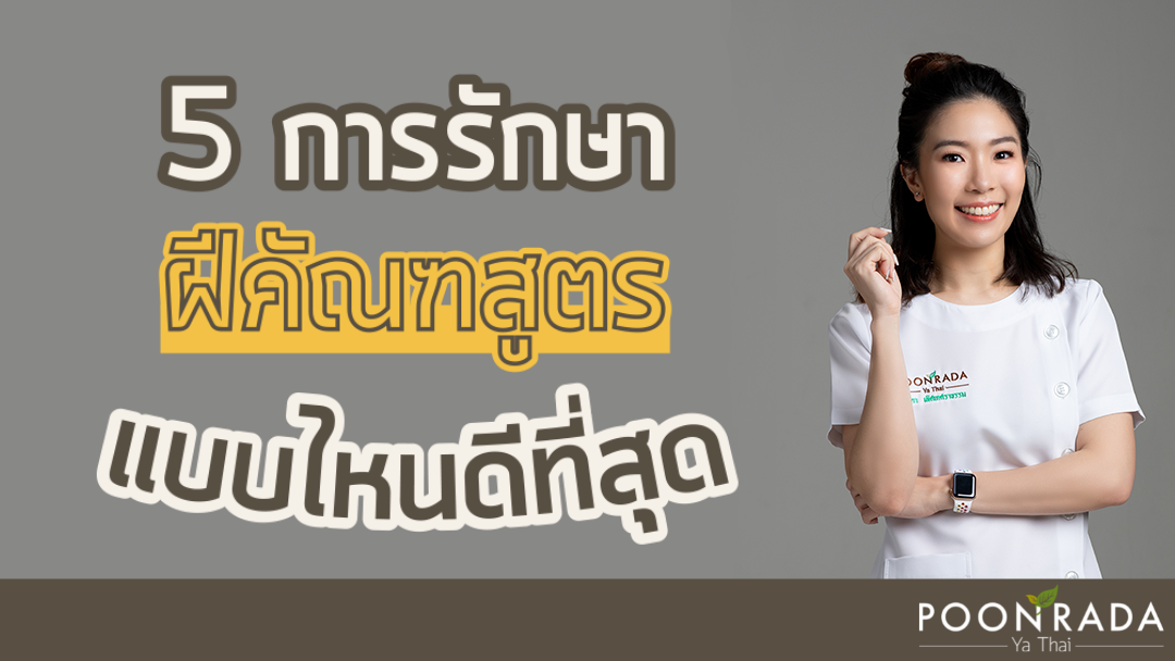 5 การรักษาฝีคัณฑสูตร แบบไหนดีที่สุด!