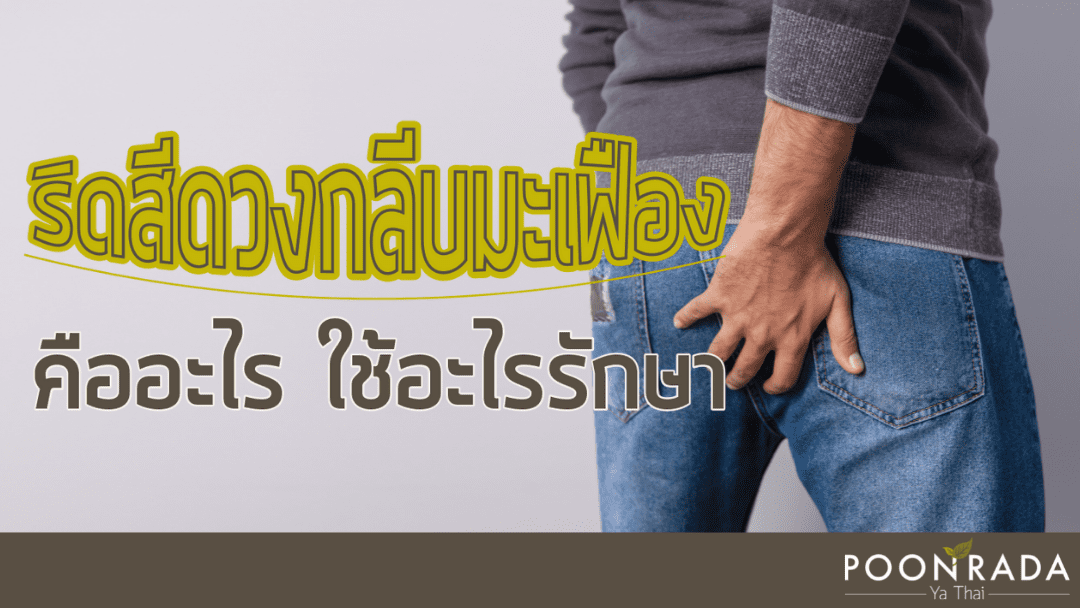 ริดสีดวงกลีบมะเฟืองคืออะไร ใช้อะไรรักษา?