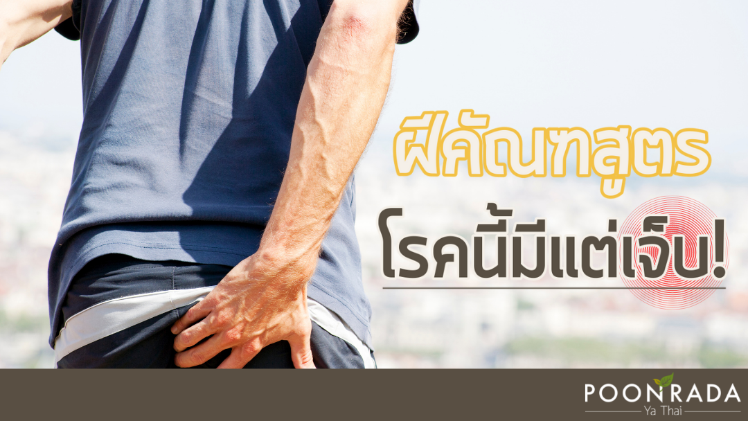 ฝีคัณฑสูตร โรคนี้มีแต่เจ็บ!