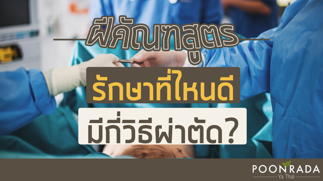 ฝีคัณฑสูตรรักษาที่ไหนดี มีกี่วิธีผ่าตัด