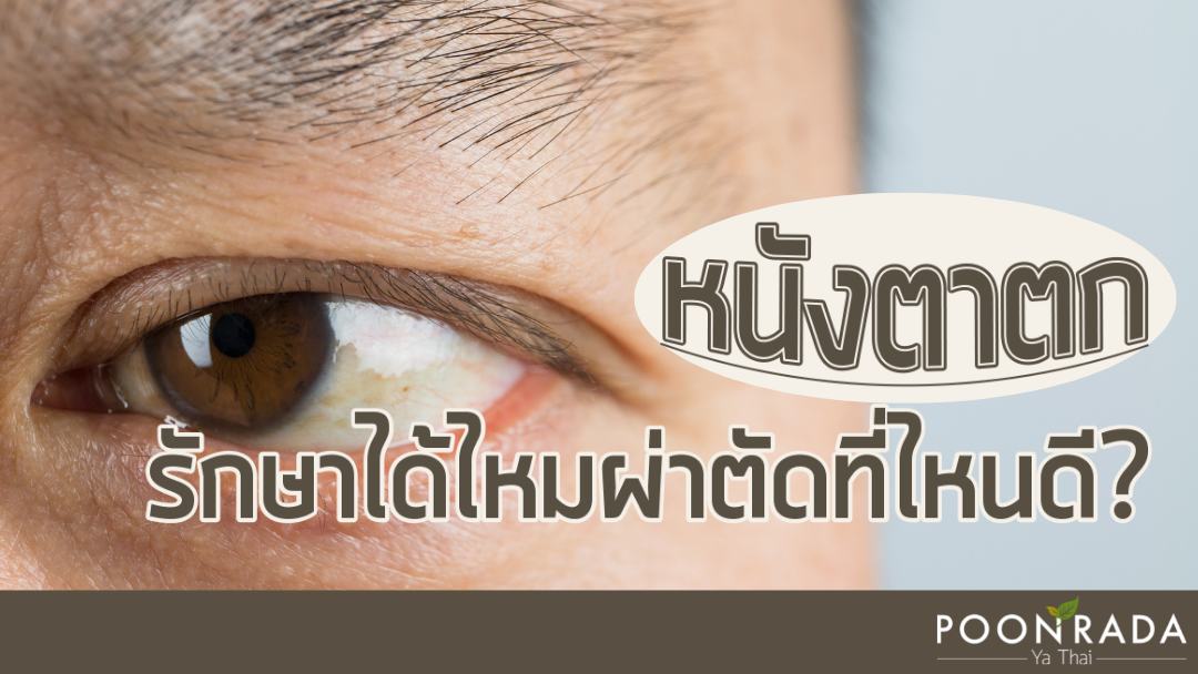 หนังตาตก รักษาได้ไหมผ่าตัดที่ไหนดี?