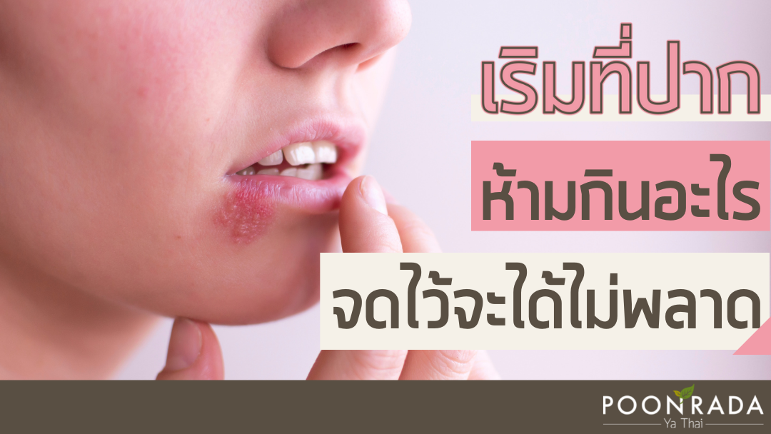 เป็นเริมที่ปาก ห้ามกินอะไร จะได้ไม่พลาด!