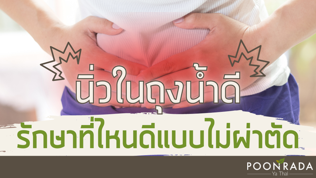 นิ่วในถุงน้ำดี รักษาที่ไหนแบบไม่ผ่าตัด