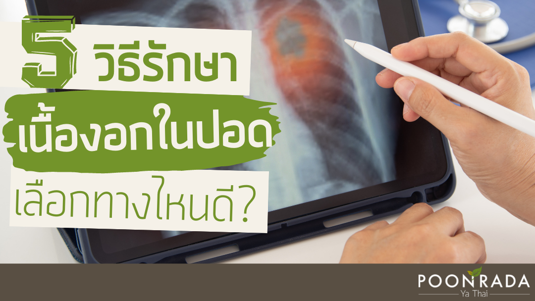 5วิธีรักษาเนื้องอกในปอด เลือกทางไหนดี?