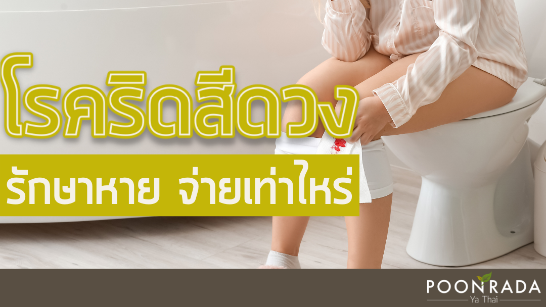 ริดสีดวง รักษาหาย จ่ายเท่าไหร่?