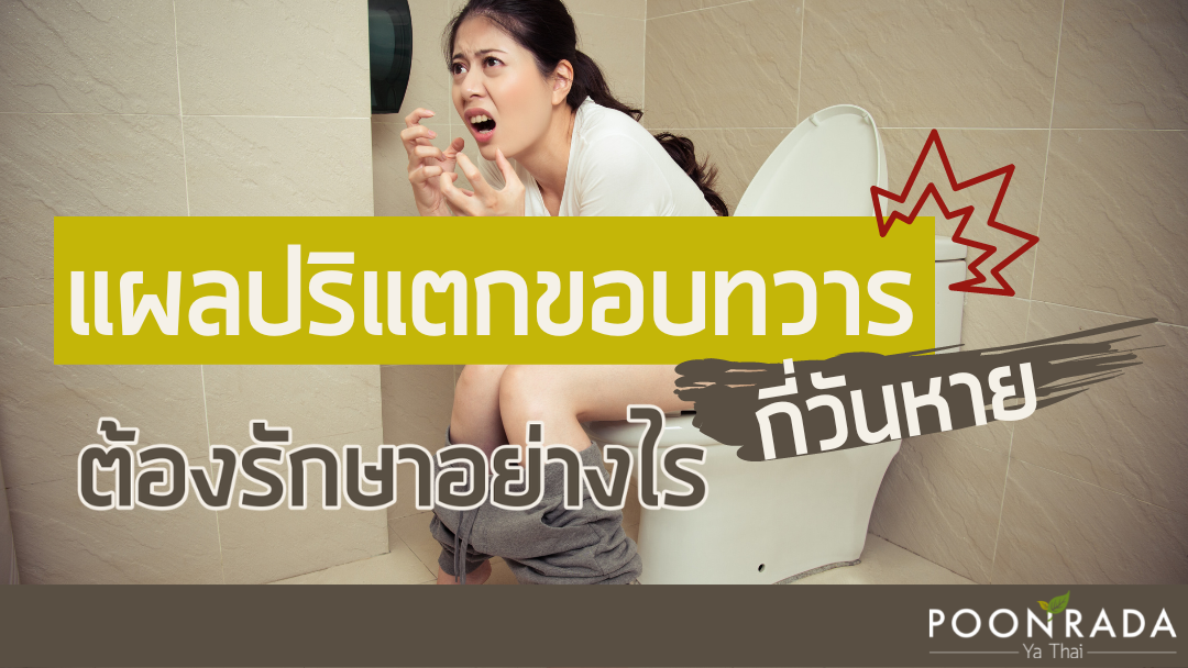 แผลปริขอบทวาร กี่วันหาย ต้องรักษาอย่างไร