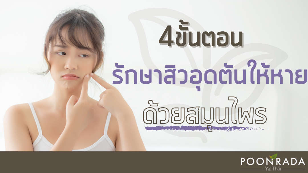 4ขั้นตอนรักษาสิวอุดตันให้หายด้วยสมุนไพร แบบธรรมชาติ