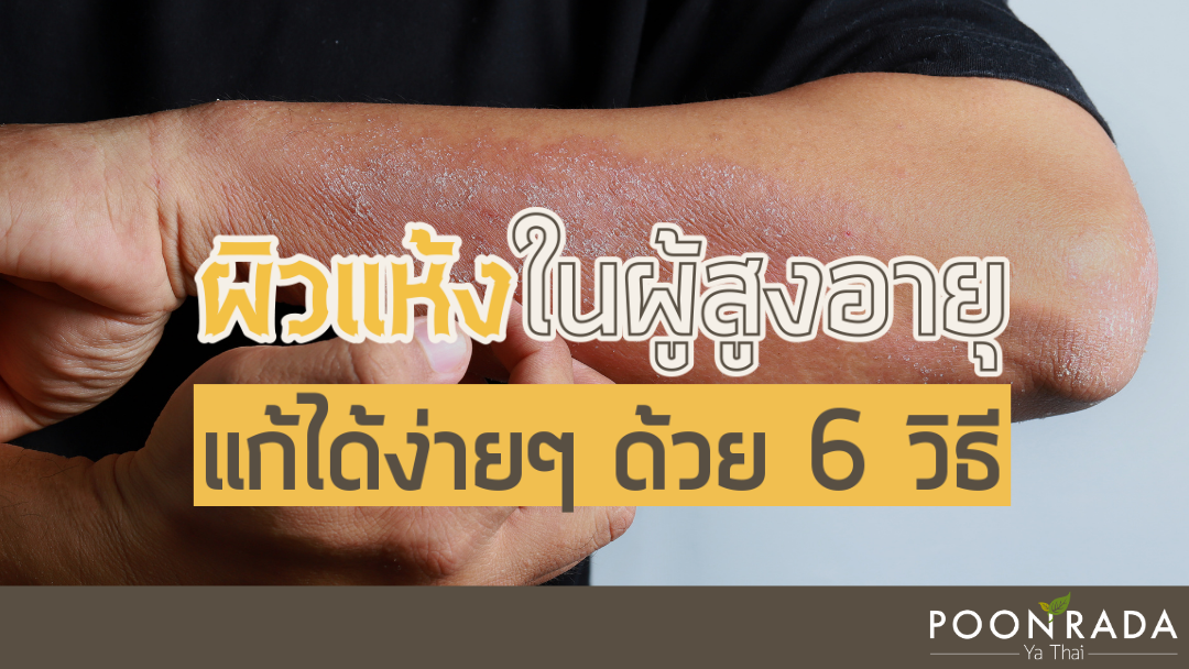 ผิวแห้งในผู้สูงอายุ แก้ง่ายๆด้วย 6 วิธี