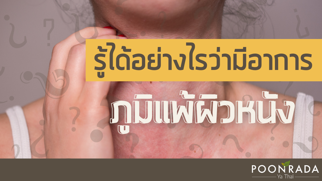 รู้ได้อย่างไรว่ามีอาการภูมิแพ้ผิวหนัง?