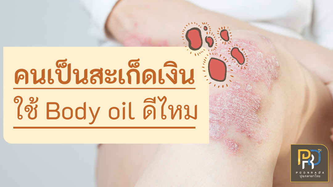 คนเป็นสะเก็ดเงินใช้ Body oil ดีไหม? แนะนำออยล์ทาผิวสำหรับสะเก็ดเงิน