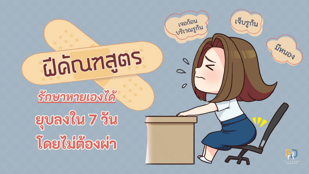 แชร์เคล็ดลับ! 3 ขั้นตอนรักษาฝีคัณฑสูตร ด้วยสมุนไพร  ฝีหายเองได้ ฝ่อ แห้ง ยุบ แก้ที่ต้นเหตุ ไม่ต้องผ่าตัด 
