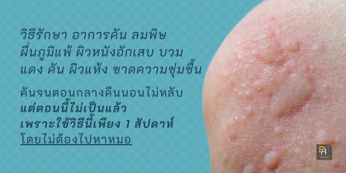 ชุดยาสมุนไพร กิน+ทา แก้ ผื่น คัน ผิวหนังอักเสบ ภูมิแพ้ผิวหนังอักเสบ บวม แดง ทั้งภายนอก และ ภายใน